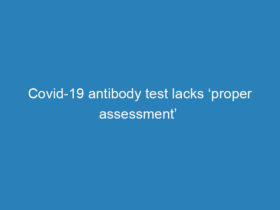 covid-19-antibody-test-lacks-proper-assessment